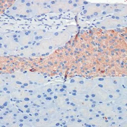 Anti-KIF5B antibody used in IHC (Paraffin sections) (IHC-P). GTX66352
