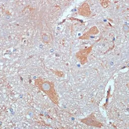 Anti-KIF5B antibody used in IHC (Paraffin sections) (IHC-P). GTX66352