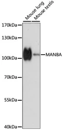 Anti-MANBA antibody used in Western Blot (WB). GTX66354
