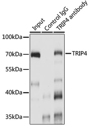 Anti-ASC1 antibody used in Immunoprecipitation (IP). GTX66364