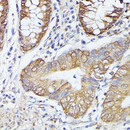 Anti-ASC1 antibody used in IHC (Paraffin sections) (IHC-P). GTX66364