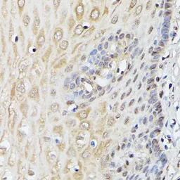 Anti-ASC1 antibody used in IHC (Paraffin sections) (IHC-P). GTX66364