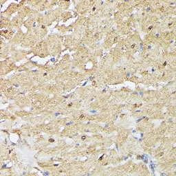 Anti-ASC1 antibody used in IHC (Paraffin sections) (IHC-P). GTX66364
