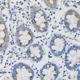 Anti-SDF4 antibody used in IHC (Paraffin sections) (IHC-P). GTX66381