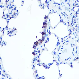 Anti-TOP1MT antibody used in IHC (Paraffin sections) (IHC-P). GTX66397