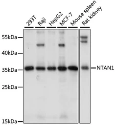 Anti-NTAN1 antibody used in Western Blot (WB). GTX66399