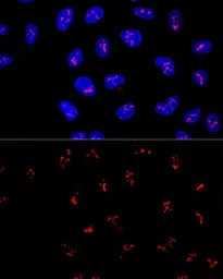 Anti-KRR1 antibody used in Immunocytochemistry/ Immunofluorescence (ICC/IF). GTX66443