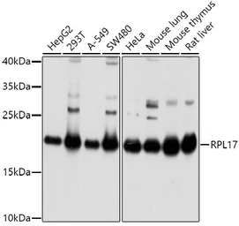 Anti-RPL17 antibody used in Western Blot (WB). GTX66472