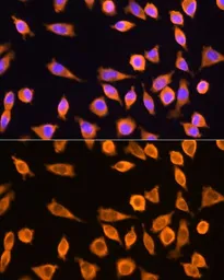 Anti-RPL17 antibody used in Immunocytochemistry/ Immunofluorescence (ICC/IF). GTX66472