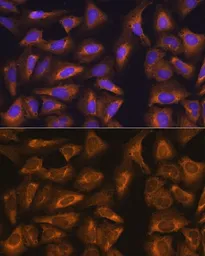 Anti-RPL17 antibody used in Immunocytochemistry/ Immunofluorescence (ICC/IF). GTX66472