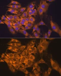Anti-RPL17 antibody used in Immunocytochemistry/ Immunofluorescence (ICC/IF). GTX66472