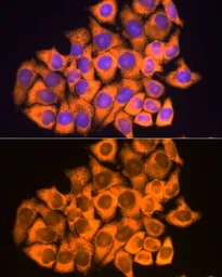 Anti-RPL17 antibody used in Immunocytochemistry/ Immunofluorescence (ICC/IF). GTX66472