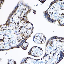 Anti-RPL17 antibody used in IHC (Paraffin sections) (IHC-P). GTX66472