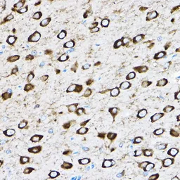 Anti-RPL17 antibody used in IHC (Paraffin sections) (IHC-P). GTX66472