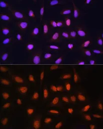 Anti-GTF2H1 antibody used in Immunocytochemistry/ Immunofluorescence (ICC/IF). GTX66483