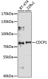 Anti-CDCP1 antibody used in Western Blot (WB). GTX66513