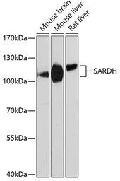 Anti-SARDH antibody used in Western Blot (WB). GTX66575