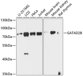 Anti-p66 beta antibody used in Western Blot (WB). GTX66580