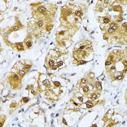 Anti-RRAGD antibody used in IHC (Paraffin sections) (IHC-P). GTX66595