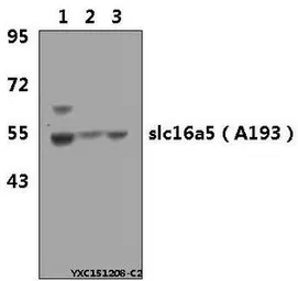 Anti-SLC16A5 antibody used in Western Blot (WB). GTX66607