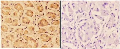 Anti-PTPRO antibody used in IHC (Paraffin sections) (IHC-P). GTX66615