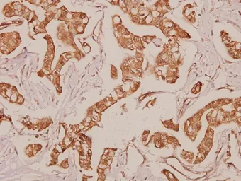 Anti-PDGF Receptor alpha antibody used in IHC (Paraffin sections) (IHC-P). GTX66642