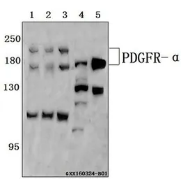 Anti-PDGF Receptor alpha antibody used in Western Blot (WB). GTX66642
