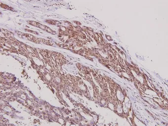 Anti-ERAP1 antibody used in IHC (Paraffin sections) (IHC-P). GTX66660