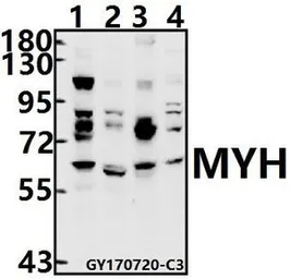 Anti-MUTYH antibody used in Western Blot (WB). GTX66680