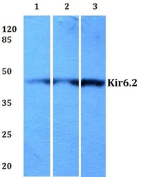 Anti-Kir6.2 antibody used in Western Blot (WB). GTX66690