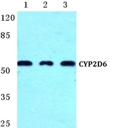 Anti-Cytochrome P450 2D6 antibody used in Western Blot (WB). GTX66736