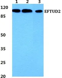 Anti-EFTUD2 antibody used in Western Blot (WB). GTX66744