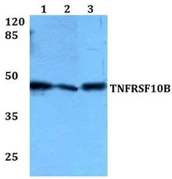 Anti-DR5 antibody used in Western Blot (WB). GTX66750