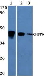Anti-CHST6 antibody used in Western Blot (WB). GTX66796