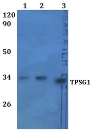 Anti-TPSG1 antibody used in Western Blot (WB). GTX66867
