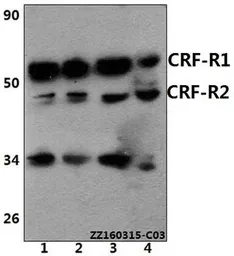 Anti-CRHR1 + CRHR2 antibody used in Western Blot (WB). GTX66871