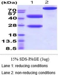 Mouse IL12 protein, His tag (active). GTX66878-pro