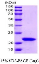 SlyD protein (active). GTX66883-pro