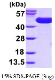 SurA protein, His tag (active). GTX66888-pro