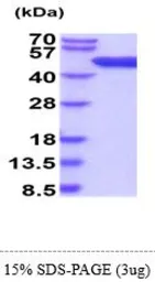 Mouse Adenosine kinase protein, His tag (active). GTX66904-pro