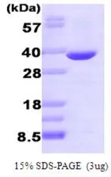 Human AKR1B1 protein (active). GTX66910-pro