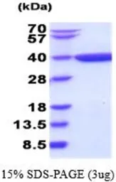 Human AKR1C1 protein (active). GTX66913-pro