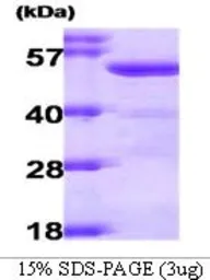 Human ALDH2 protein (active). GTX66919-pro