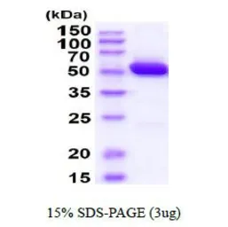 Mouse ALDH2 protein, His tag (active). GTX66920-pro