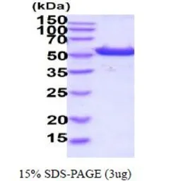 Human ALDH3A1 protein, His tag (active). GTX66921-pro