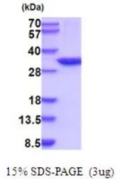 Human CA13 protein, His tag (active). GTX66932-pro