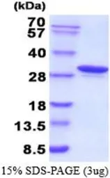 Human Carbonic Anhydrase 1 protein, His tag (active). GTX66934-pro
