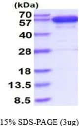 Human Catalase protein, His tag (active). GTX66938-pro
