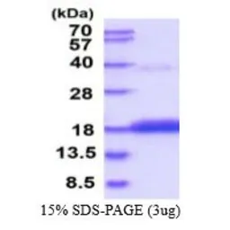 Human CDA protein, His tag (active). GTX66943-pro