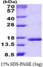 Human Cystatin C protein, His tag (active). GTX66962-pro